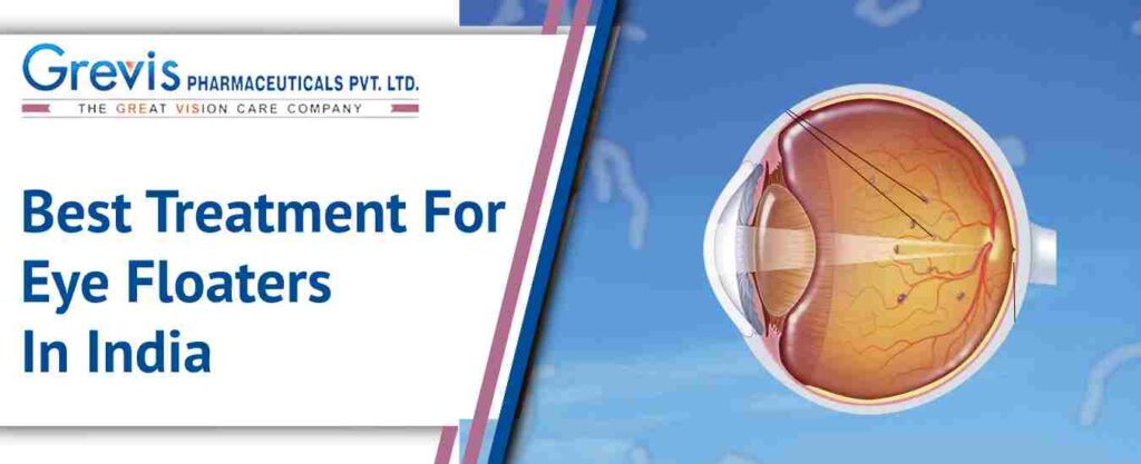 Best Treatment For Eye Floaters In India | Causes, Symptoms & Solutions